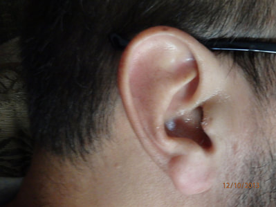 male ear close up